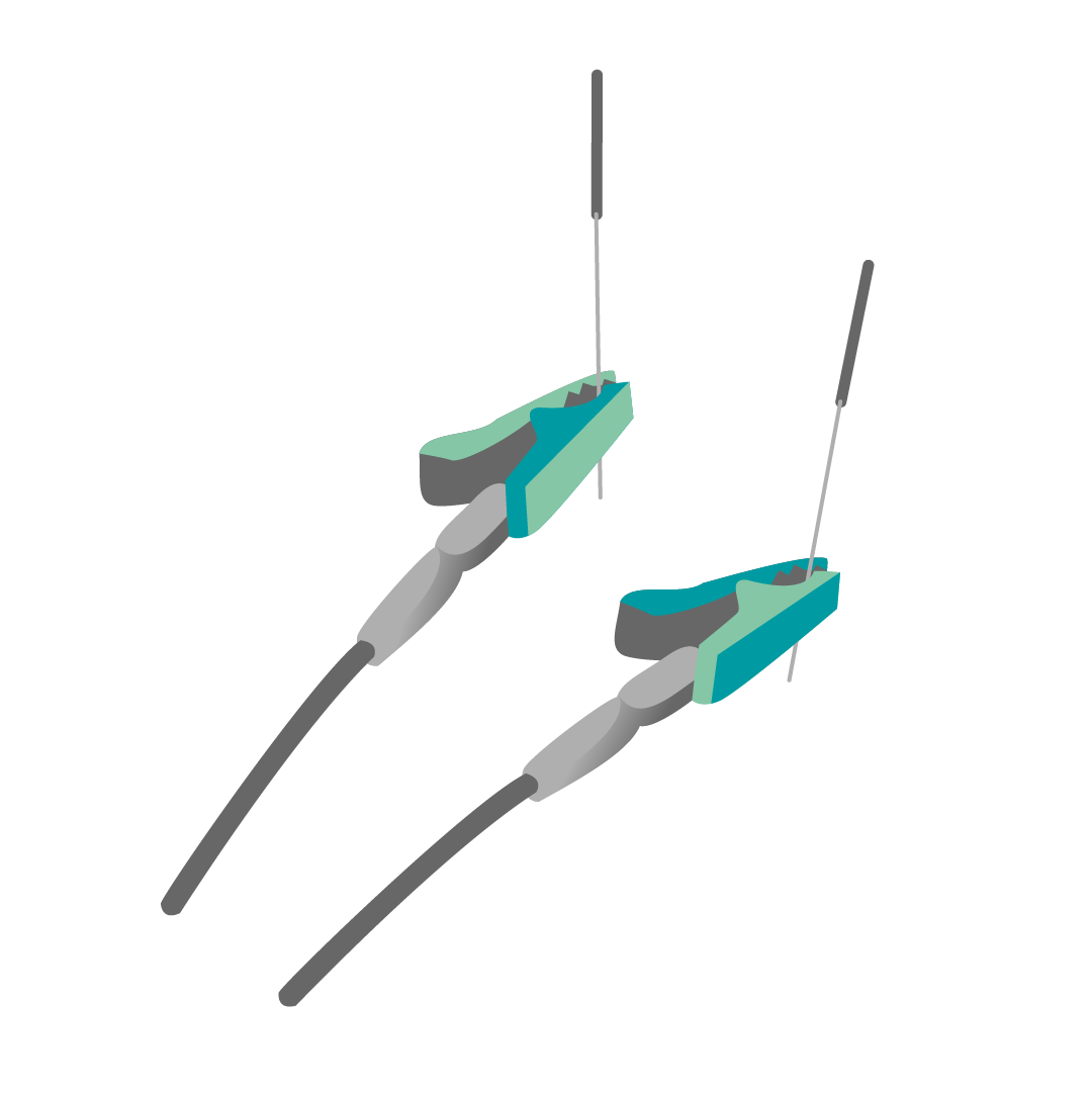 Neuromodulación percutánea
